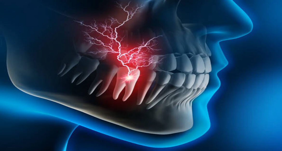 Kill Tooth Pain Nerve in 3 Seconds Permanently