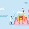 How Long Does a Root Canal Take